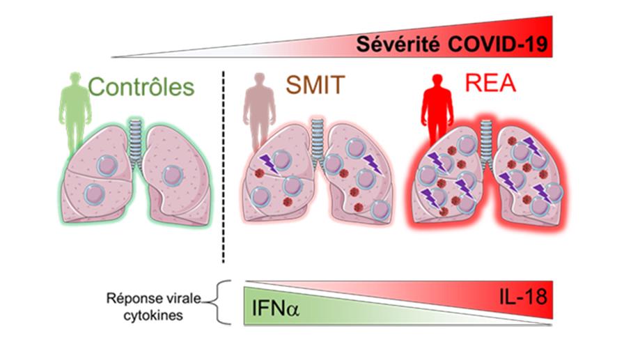 Chez les patients COVID-19, plus la pathologie est sévère, plus les cellules MAIT sont recrutées dans les poumons, elles produisent des cytokines pro-inflammatoires et deviennent des cellules tueuses pouvant endommager les tissus pulmonaires. Ces modifications pathologiques des cellules MAIT sont associées à la présence accrue de monocytes/macrophages qui produisent plus d’IL-18 pro-inflammatoire et moins d’IFNα antiviral.