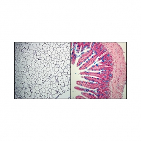https://insb.cnrs.fr/fr/cnrsinfo/obesite-des-cellules-immunitaires-associees-aux-muqueuses-induisent-inflammation-et